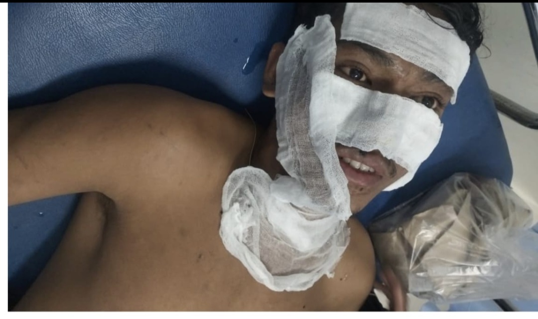 Pekerja CV Anugrah Cahaya Sawita Alami Kecelakaan Kerja, Diduga Belum Terdaftar BPJS Ketenagakerjaan